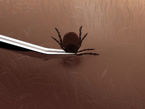 for proper tick removal, gently pull upwards with pointy-tipped tweezers