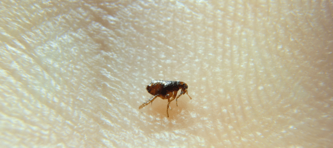 a flea on someone's hand