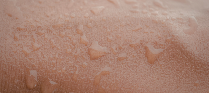 sweat on skin